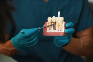 illustrating dental implant procedure on model 2025 01 31 05 02 08 utc